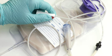 Plano de saúde é obrigado a fornecer dieta enteral a pessoa com deficiência