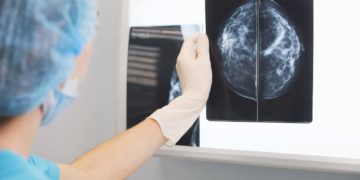 TJRN e Grupo Reviver oferecem 70 exames de mamografia em ação cidadã nesta sexta (8)