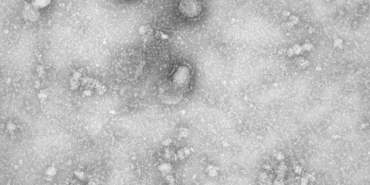 Publicada MP que destina recursos para enfrentamento do coronavírus