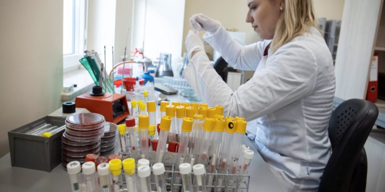 Chegam ao Brasil 500 mil testes para diagnóstico da covid-19