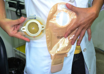 Estado tem 20 dias para regularizar serviço prestado a pacientes ostomizados