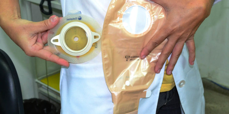 Estado tem 20 dias para regularizar serviço prestado a pacientes ostomizados