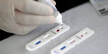 Covid-19: governo anuncia plano de testes