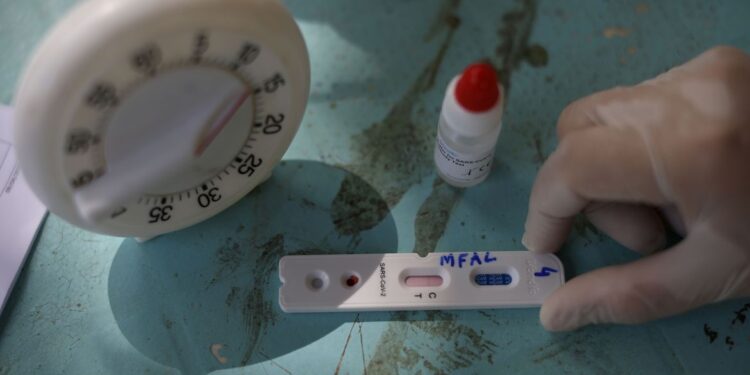 Planos de Saúde terão a obrigatoriedade de cobrir a realização de testes para detecção da Covid-19