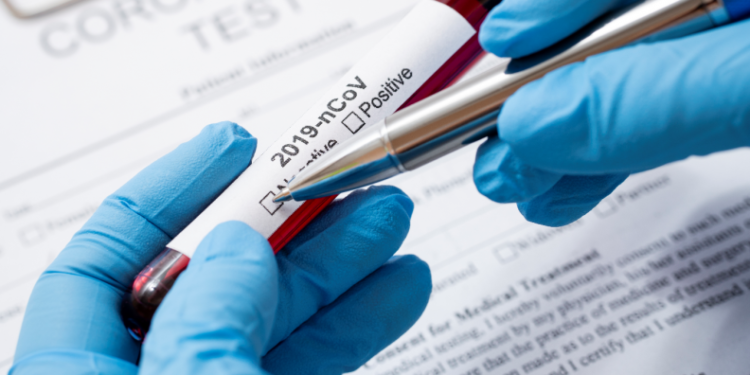 TCU determina que Ministério da Saúde informe tempestivamente sobre contratações de enfretamento à Covid-19