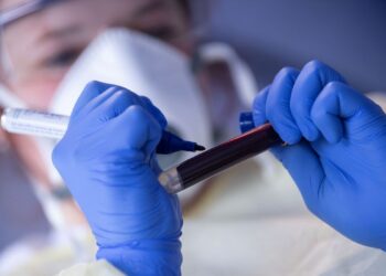 ANS retira teste para covid-19 de lista obrigatória de cobertura