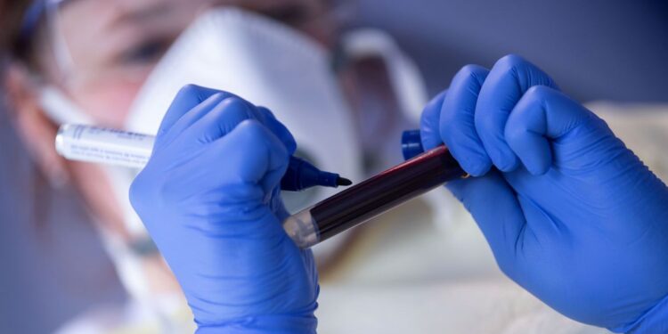 ANS retira teste para covid-19 de lista obrigatória de cobertura