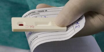ANS decide se testes para covid-19 continuam obrigatórios