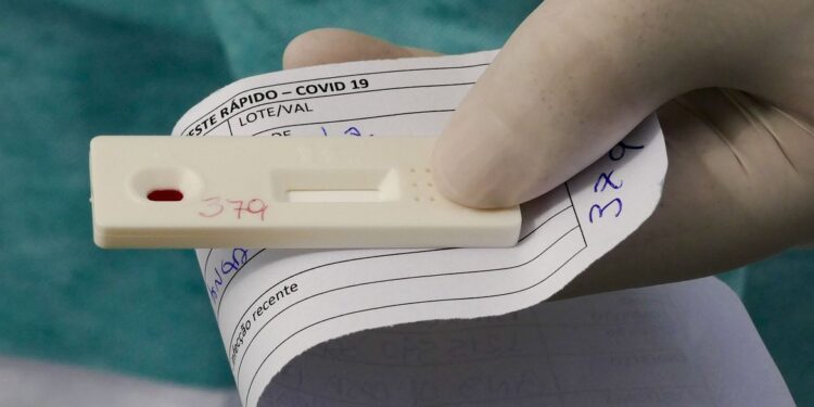 ANS decide se testes para covid-19 continuam obrigatórios