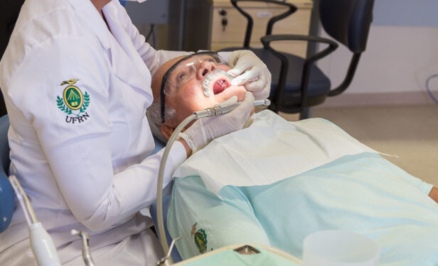 Técnica desenvolvida por pesquisadores da UFRN elimina dor em tratamento contra cárie