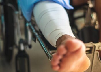 Auxílio-acidente deve começar no dia seguinte ao fim do auxílio-doença que lhe deu origem