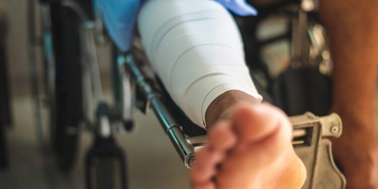 Auxílio-acidente deve começar no dia seguinte ao fim do auxílio-doença que lhe deu origem