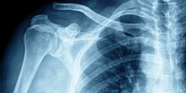 Carteiro garante recebimento de pensão vitalícia na justiça do Trabalho