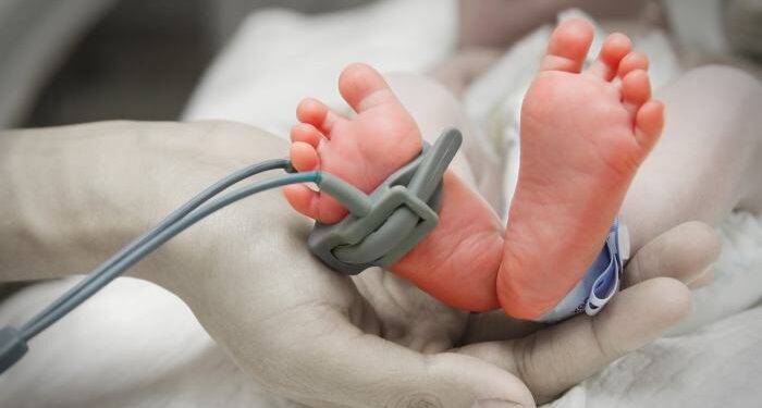 Maternidade Escola Januário Cicco deve garantir número mínimo de fisioterapeutas e assistência integral em UTIs