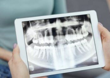 Cirurgia de reconstrução de mandíbula de paciente deve ser custeada por plano de saúde, decide TJ/RN