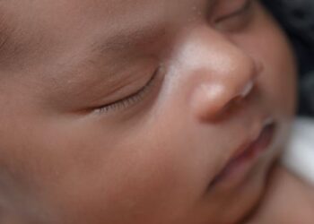 TJ mantém liminar e determina que plano de saúde realize cirurgia de crânio em bebê com três meses de vida