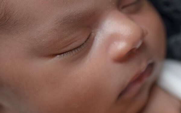 TJ mantém liminar e determina que plano de saúde realize cirurgia de crânio em bebê com três meses de vida