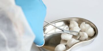 Paciente com calcucose garante na justiça direito a custeio de cirurgia paga por plano de saúde