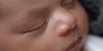 Internação de recém-nascida em leito de UTI Neonatal deve ser custeada por plano de saúde, decide TJ/RN