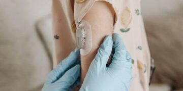 Justiça determina que Plano de Saúde forneça sensor de glicose e indenize paciente em R$ 4 mil