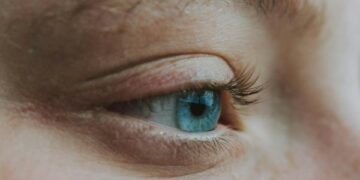 Paciente garante indenização e custerio de cirurgia ocular