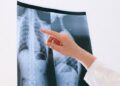 Paciente será indenizado por Plano de Saúde após demora de aturização de cirurgia