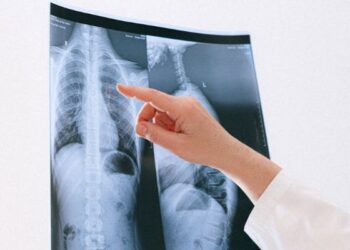 Paciente será indenizado por Plano de Saúde após demora de aturização de cirurgia