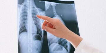 Paciente será indenizado por Plano de Saúde após demora de aturização de cirurgia