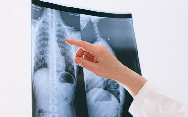 Paciente será indenizado por Plano de Saúde após demora de aturização de cirurgia
