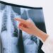 Paciente será indenizado por Plano de Saúde após demora de aturização de cirurgia