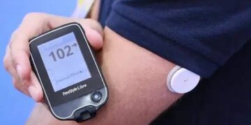 Adolescente de 15 anos consegue sensor de glicemia após pedido da Defensoria na Justiça