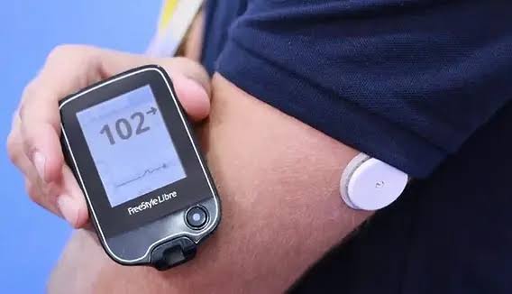 Adolescente de 15 anos consegue sensor de glicemia após pedido da Defensoria na Justiça