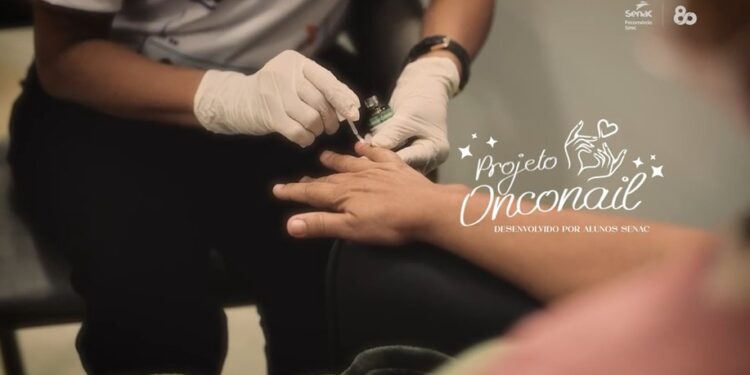 Série de TV dos 80 anos do Senac revela como alunas de Manicure e Pedicure do RN criaram produto para pacientes oncológicos
