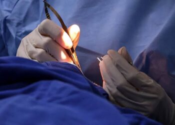 Paciente receberá R$ 20 mil após sofrer queimadura durante cirurgia em hospital de Natal