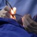Paciente receberá R$ 20 mil após sofrer queimadura durante cirurgia em hospital de Natal